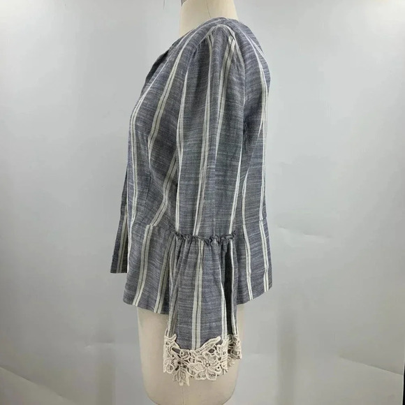 Zara Gray and White Striped Jacket - Picture 2 of 13